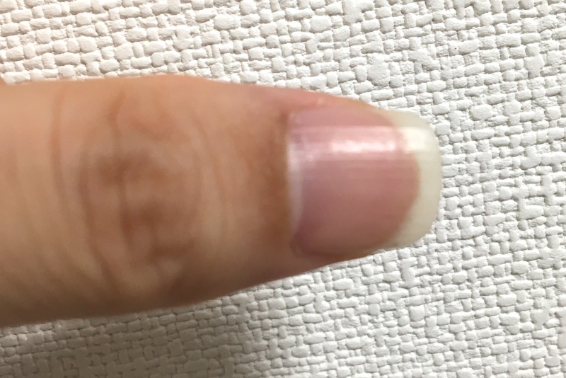 解説まとめ 爪の縦シワ 爪甲縦条は加齢と乾燥が原因 爪の縦筋を防ぐ3つのおすすめ予防ケア アスリートサロン アスリートネイル ケアで爪を強く美しく爪 のコンディショニング専門メディア
