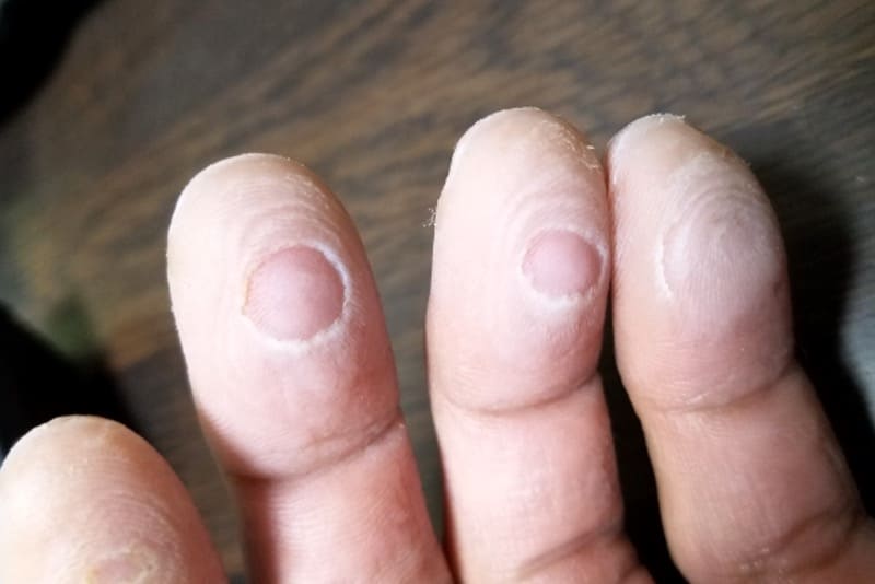指皮を守るクライマー必見の保湿クリーム And クライミングで裂ける剥ける指皮ケアに アスリートサロン アスリートネイル ケアで爪を強く美しく爪のコンディショニング専門メディア